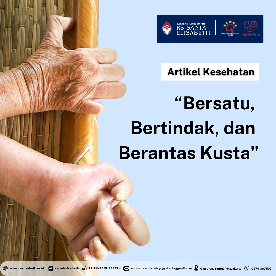 Bersatu, Bertindak dan Berantas Kusta